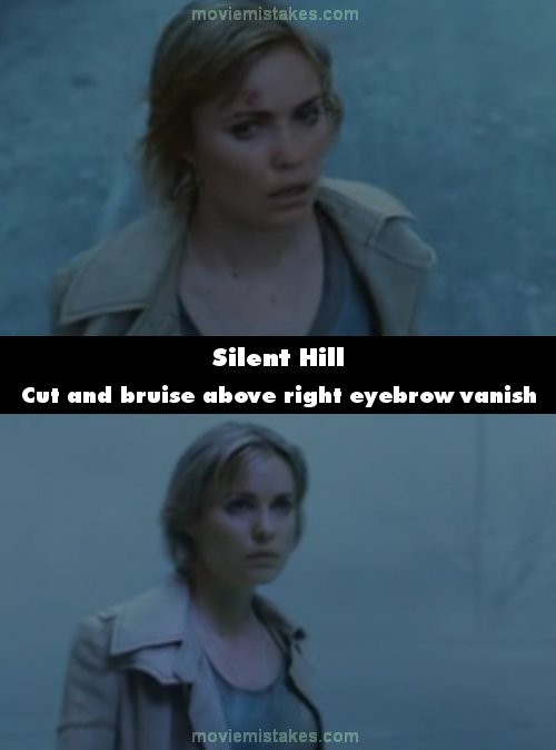 Phim Silent Hill (Ngọn đồi câm lặng), vết thâm tím trên trán Rose biến mất trong một cảnh quay